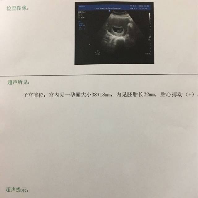北京正规代孕资讯，北京466人流，北京466人流价格