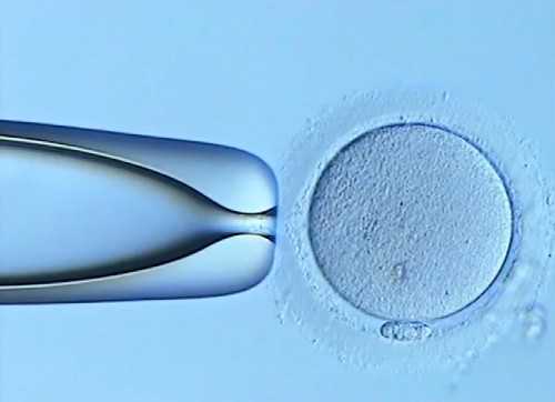 供卵前染色体异常筛查技术全面解析与流程指南