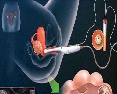 遗传病家庭上海供卵代生常见问题全解析